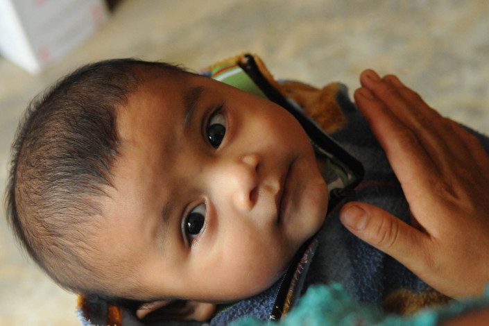 A 6-month-old is held by his mother at a health center in rural Guatemala.