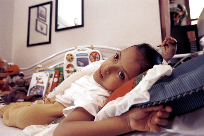 A boy with Spina Bifida lays in his bed attached to a ventilator.